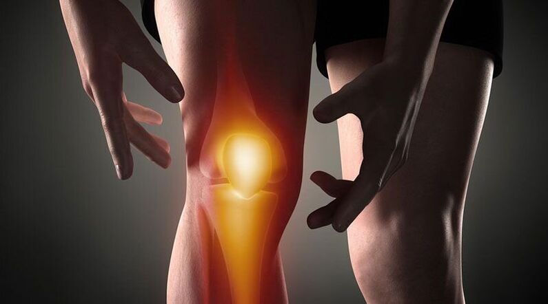 Disturbi dei processi metabolici nelle strutture dell'articolazione possono provocare dolore al ginocchio