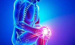 fasi di artrosi dell'articolazione del ginocchio